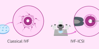 Know About ICSI And IVF